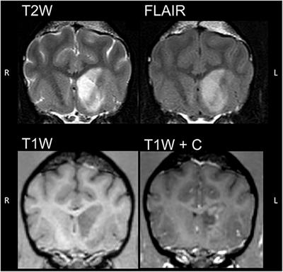 Striate Artery Infarct After Bilateral Carotid Artery Ligation (BCAL) in a Dog: A Multimodal MRI Study